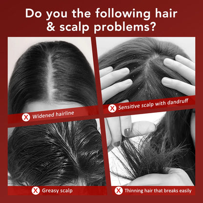 Brosse Électrique de Repousse Capillaire avec Lumière Infrarouge – Appareil de Massage du Cuir Chevelu par Acupression, Anti-Chute de Cheveux et Peigne Massant Stimulateur