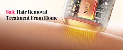 Épilateur IPL 990 000 flashs pour femmes  – épilation durable et indolore pour le corps, le bikini et le visage.