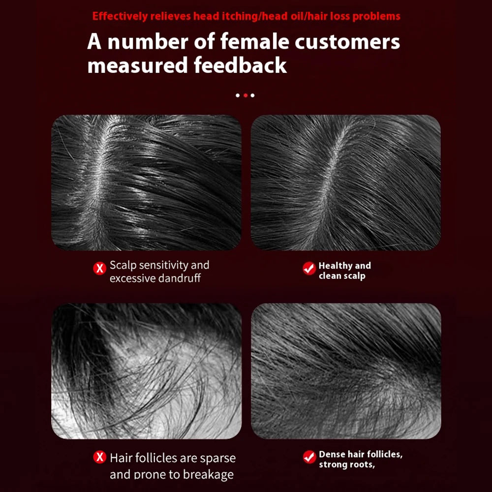 Brosse Électrique de Repousse Capillaire avec Lumière Infrarouge – Appareil de Massage du Cuir Chevelu par Acupression, Anti-Chute de Cheveux et Peigne Massant Stimulateur