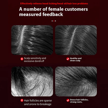 Brosse Électrique de Repousse Capillaire avec Lumière Infrarouge – Appareil de Massage du Cuir Chevelu par Acupression, Anti-Chute de Cheveux et Peigne Massant Stimulateur